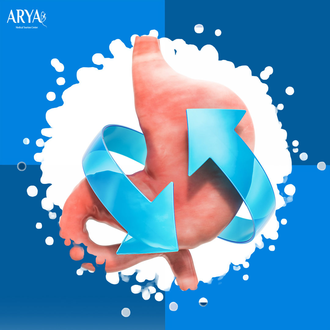 تحويل مسار المعدة